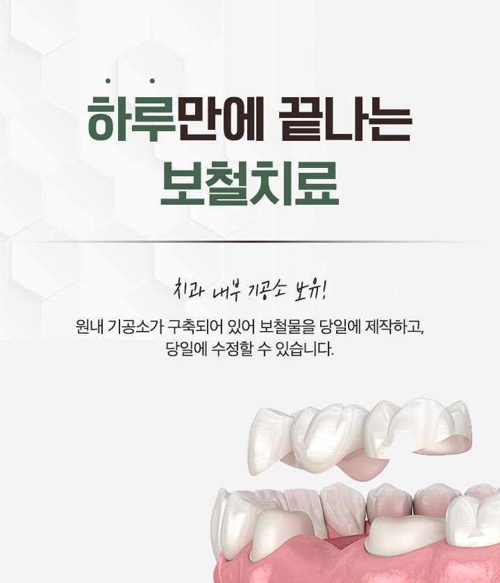 가우정치과-m롤링02