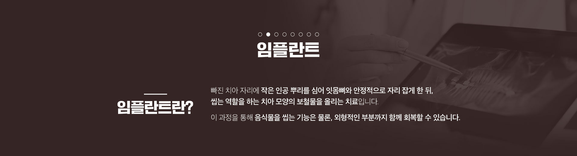 가우정치과-임플란트