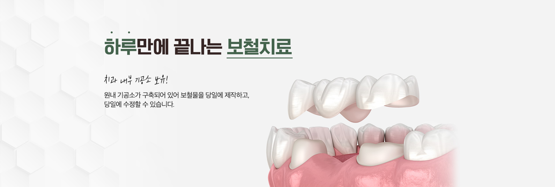 가우정치과-메인롤링02