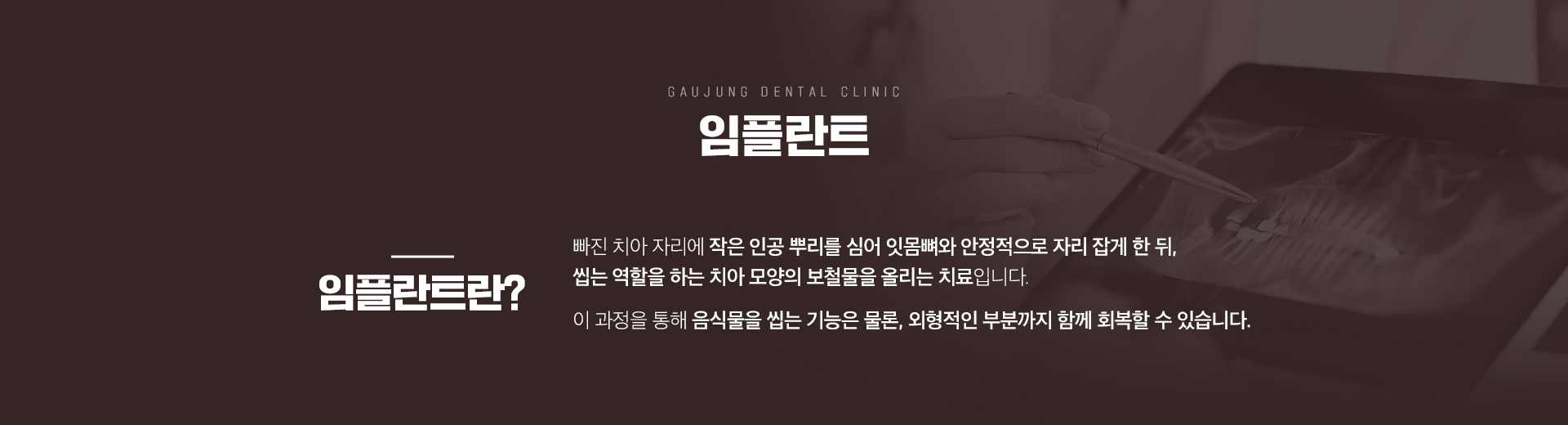 가우정치과 임플란트