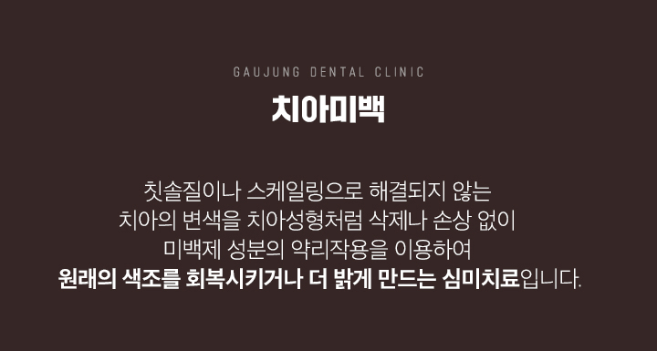 가우정치과 치아미백